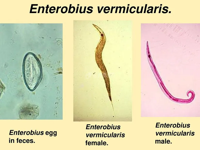 Enterobius+vermicularis..jpg