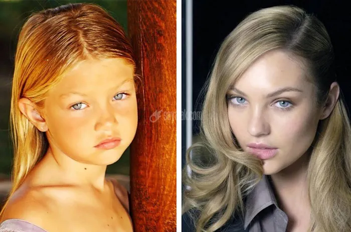 Gigi-Hadids-Lips-Before-and-After.jpg